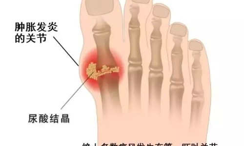 精神病人有停药成功的吗-精神病人停药的后果网 - 网站提供精神病患者停药后多久病发作小常识、精神病人停药后的表现